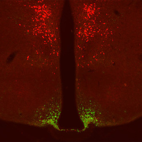 Study identifies weight-loss drug target in the brain