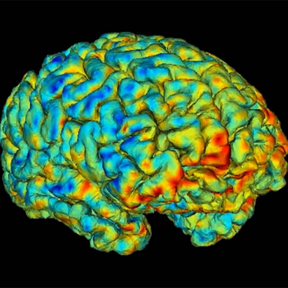 Brain Video Stirs Fascination, Goes Viral, University of Utah Health