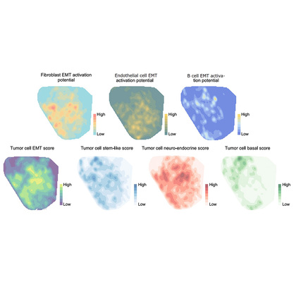 Computer model boosts detection of cell-to-cell communication