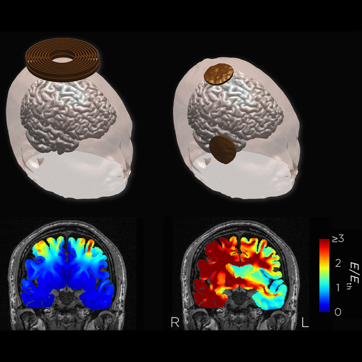 cognitive-heath-thumb.jpg