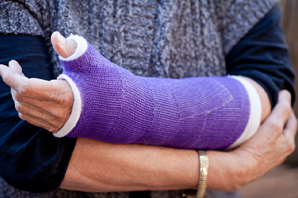 Casting call: Why immobilizing helps in healing