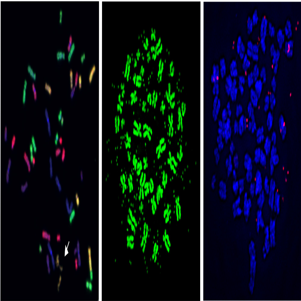 Pathway tied to cancer-driving genome alterations identified