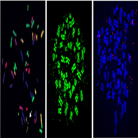 Pathway tied to cancer-driving genome alterations identified