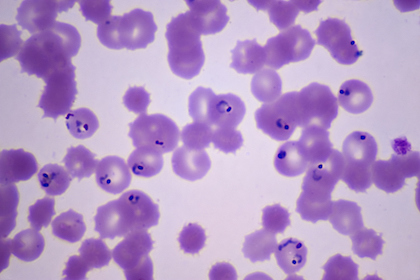 protozoa malaria