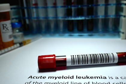 Researchers find potential new way to target lethal form of leukemia