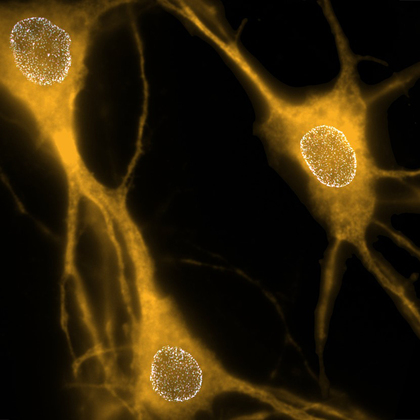 UTSW study reveals how key protein affects neuron structure