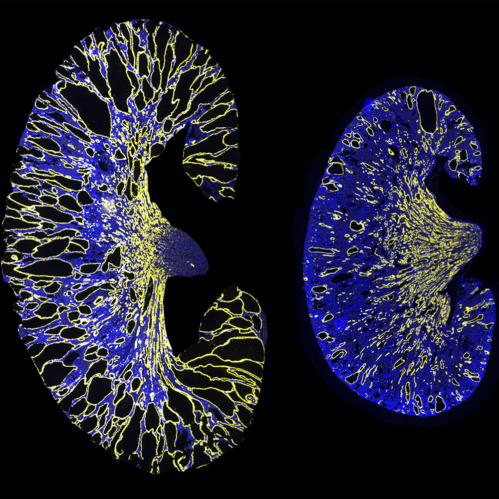 UT Southwestern Researchers Identify A Gene Therapy Target For ...