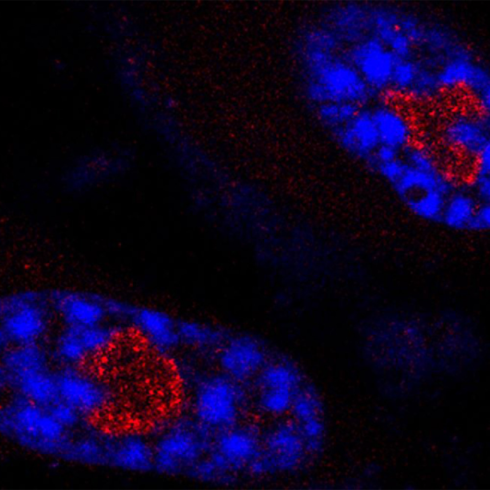 UTSW study identifies RNA molecule that regulates cellular aging