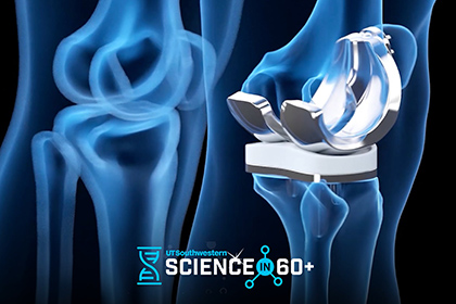 UT Southwestern Science in 60+ logo, blue hourglass over an enhanced x-ray of a prosthetic knee.