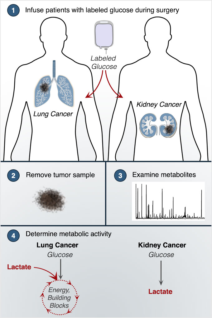 Method to analyze metabolic pathways in human tumors