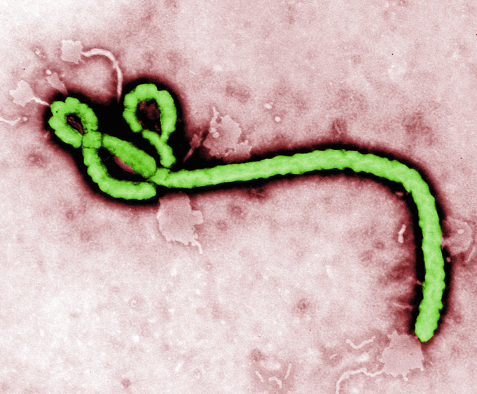 ebola