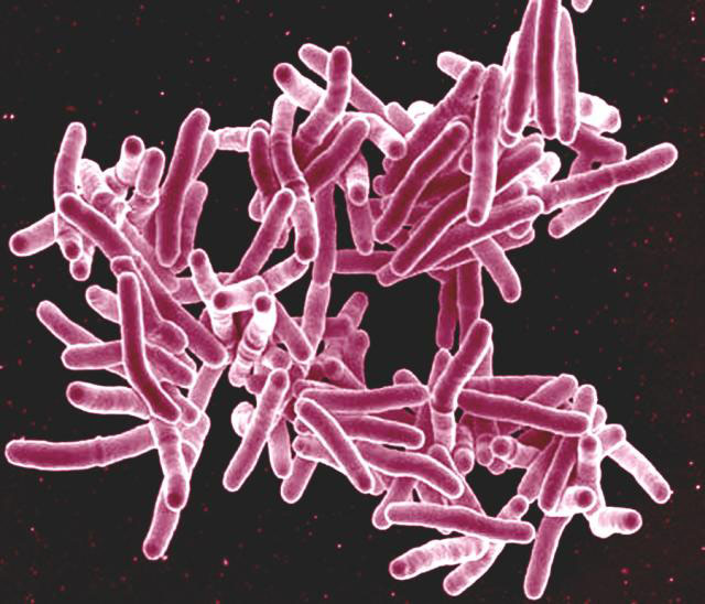 mycobacterium-tuberculosis