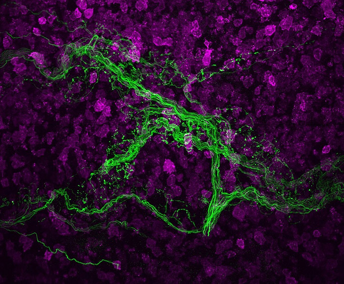 Image of the peripheral nervous system