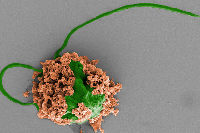 microscopic view of microbot - round green cell covered in chunky brown layer with long thin green tail