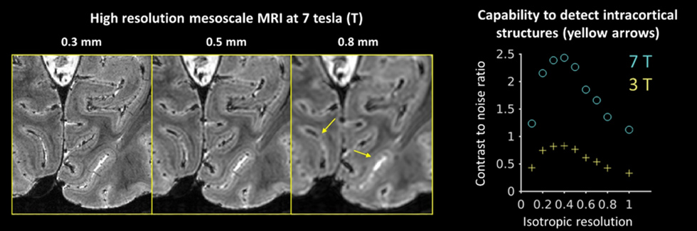 high resolution mesoscale anatomical MRI image