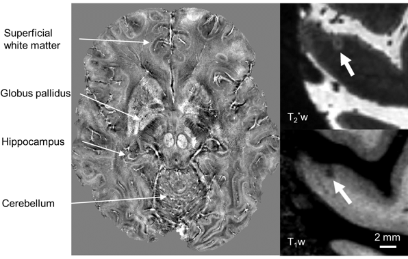 image showing quantitative neuroimaging scan
