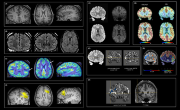 neuroimaging