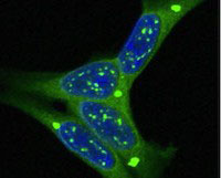 Graphic for Marc Diamond