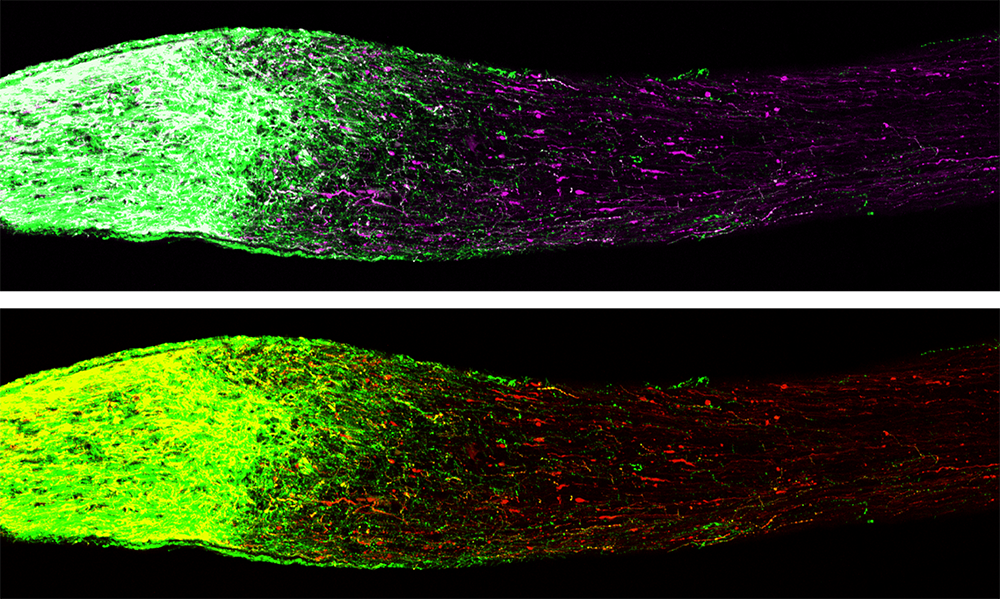 Comparison of two colorful microscope slides.