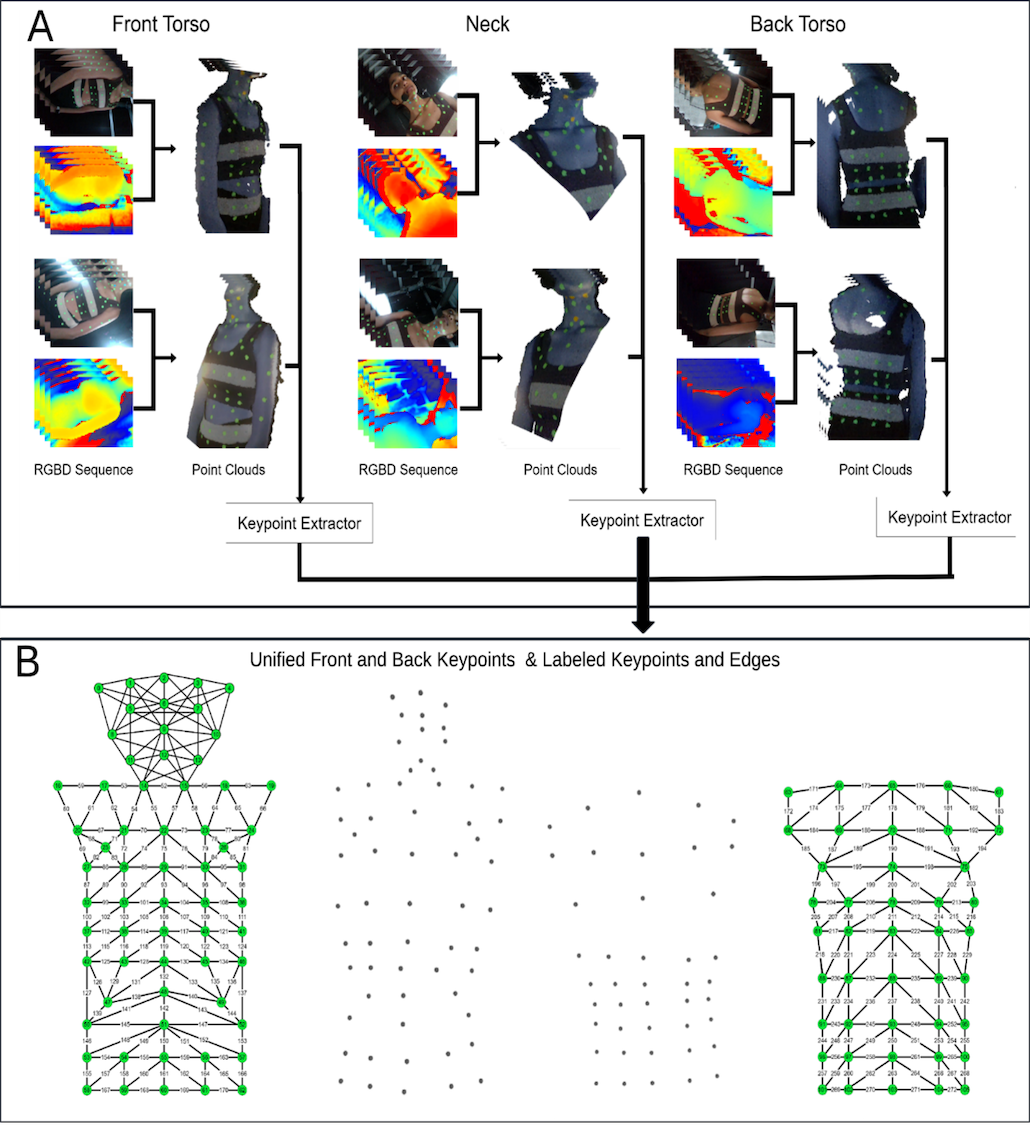Paralaryngeal-Respiratory Spatiotemporal Patterns in Muscle Tension Dysphonia