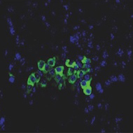 Srinivas Malladi, Ph.D. Lab