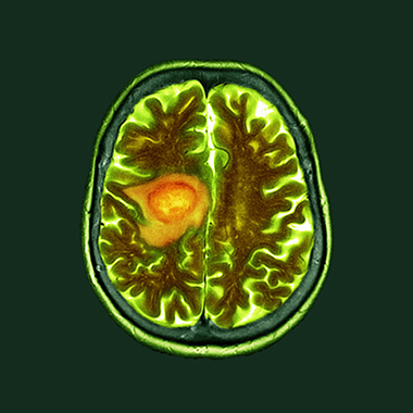 Coloured computed tomography (CT) scan of a section through the brain