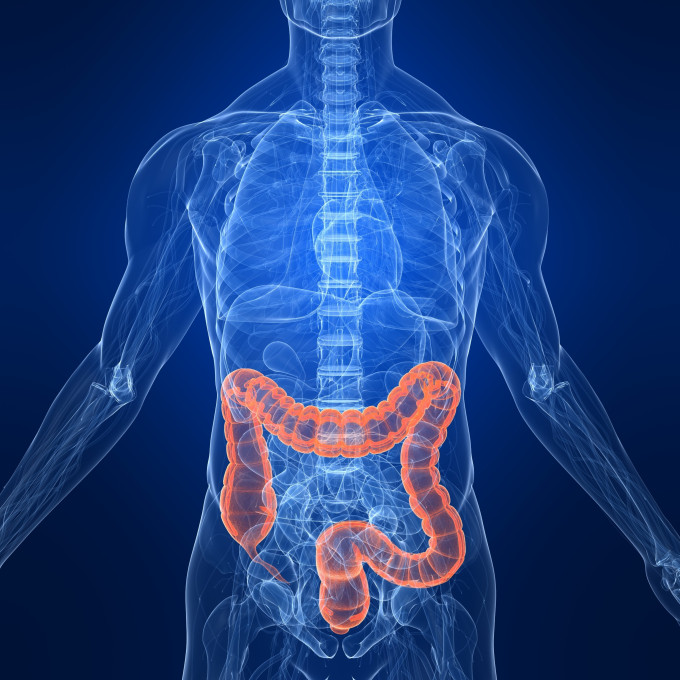 Expanding Access to Virtual Colonoscopy Will Improve Colorectal Cancer ...