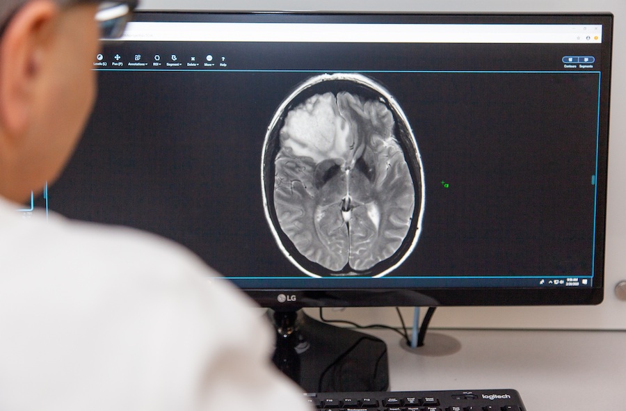 imaging of brain tumor