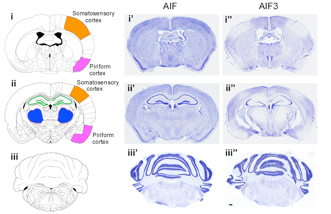 AIF3 splicing triggers neurodegeneration and neuron loss in a mouse brain, shown in the cortex (orange and pink), hippocampus (green), and thalamus (blue).