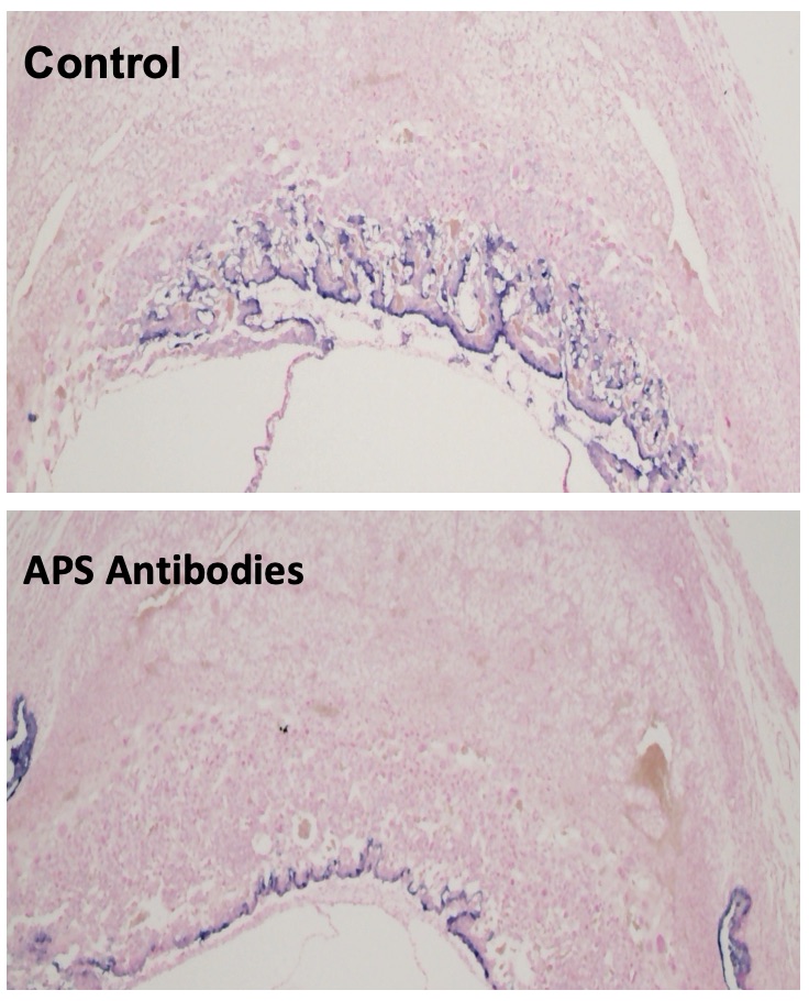 Images shows how APS antibodies inhibit trophoblast migration in the mouse placenta.