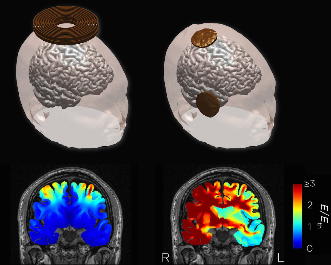 These 3D models illustrate the study's findings