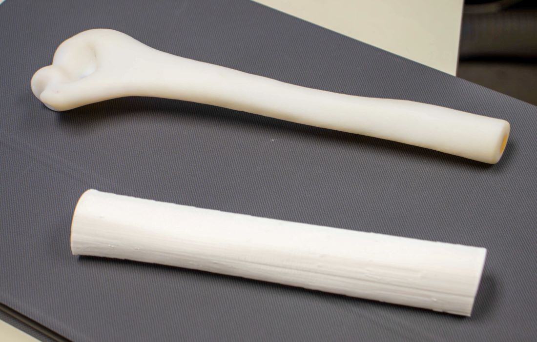 3D-printed femurs