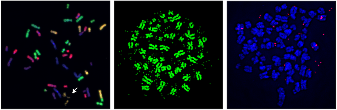 Mitotic Chromosome