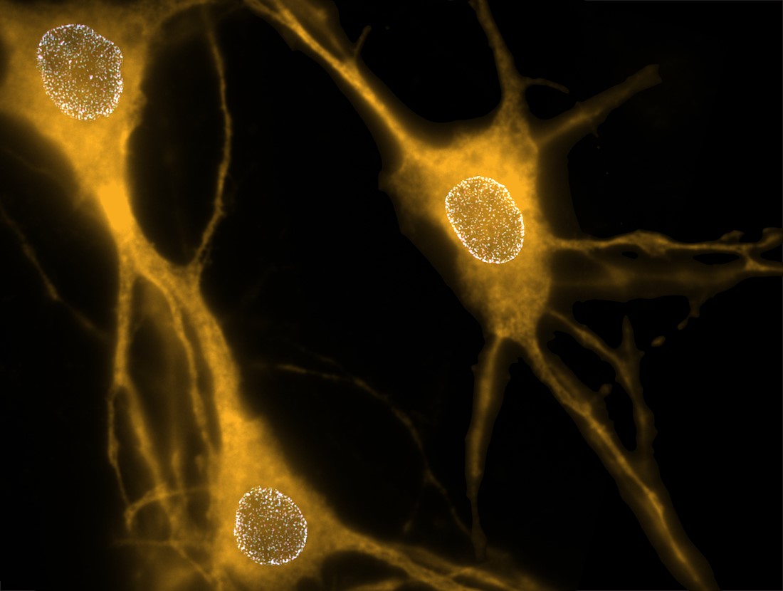 Three isolated neurons