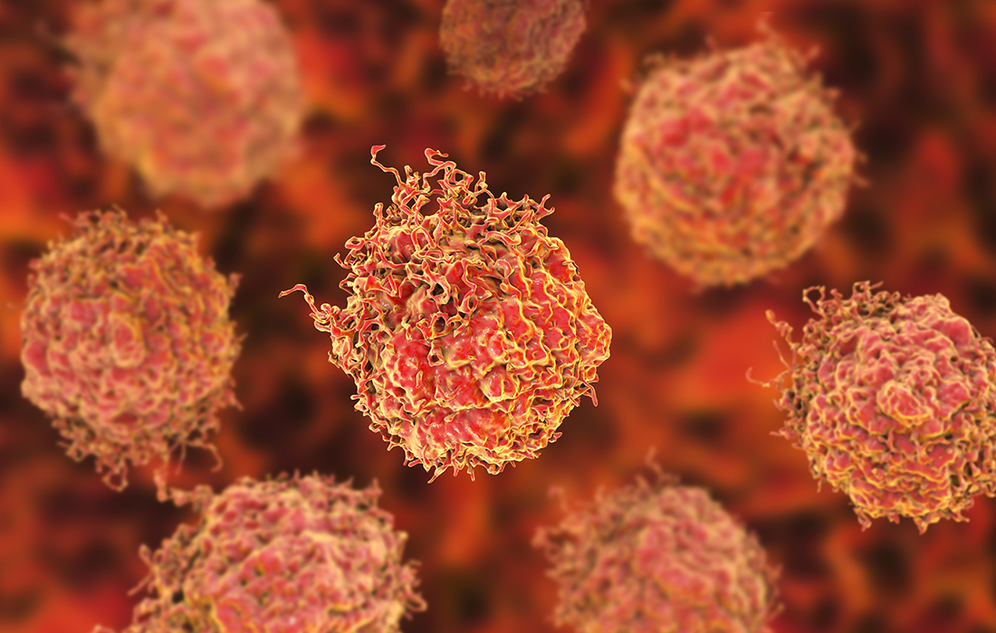3D illustration of tumor cells