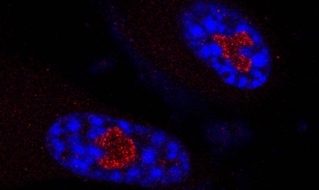 SNORA13 (red) in the nucleus of senescent human cells 