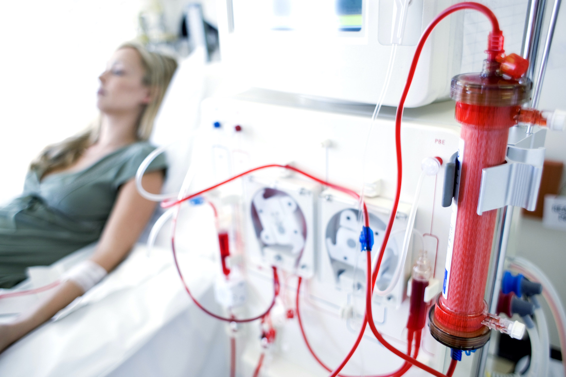 Woman getting kidney dialysis