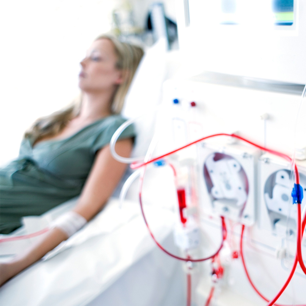 A female on dialysis in hospital bed