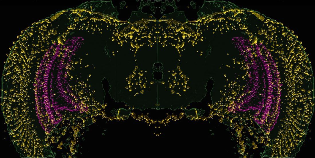 A fluorescent image shows stress-related proteins (yellow) accumulating in the brain of a visually impaired fruit fly.