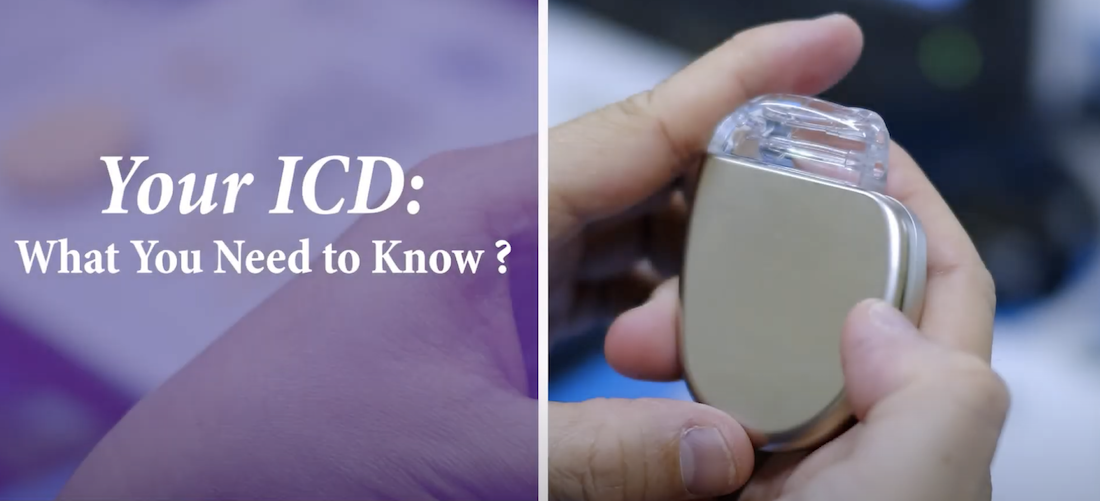 Your ICD: What You Need To Know