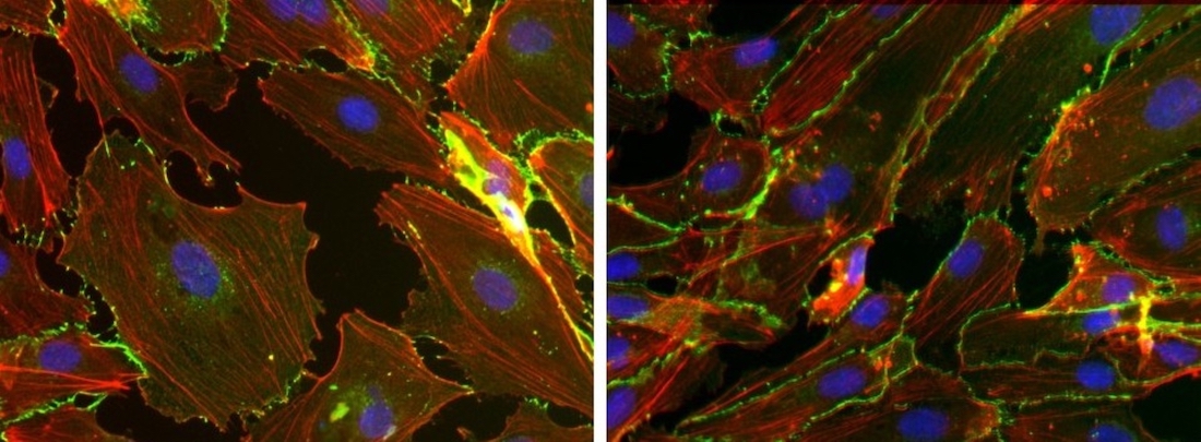 Immunofluorescence images