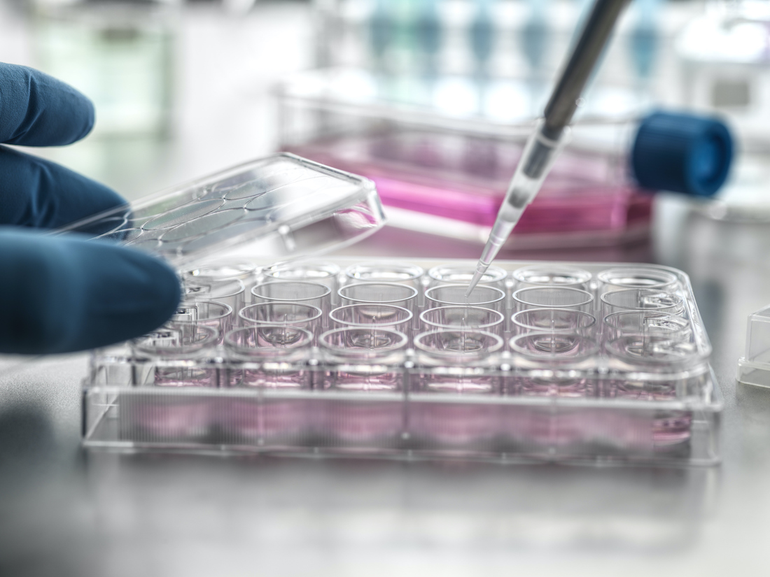 Scientist pipetting medical samples into microplate in laboratory