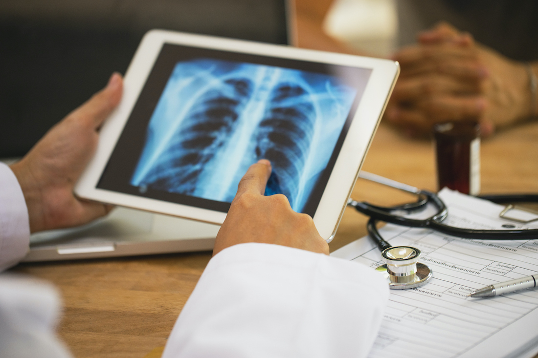 Doctor explaining results of lung check up from x-ray scan chest on digital tablet screen to patient