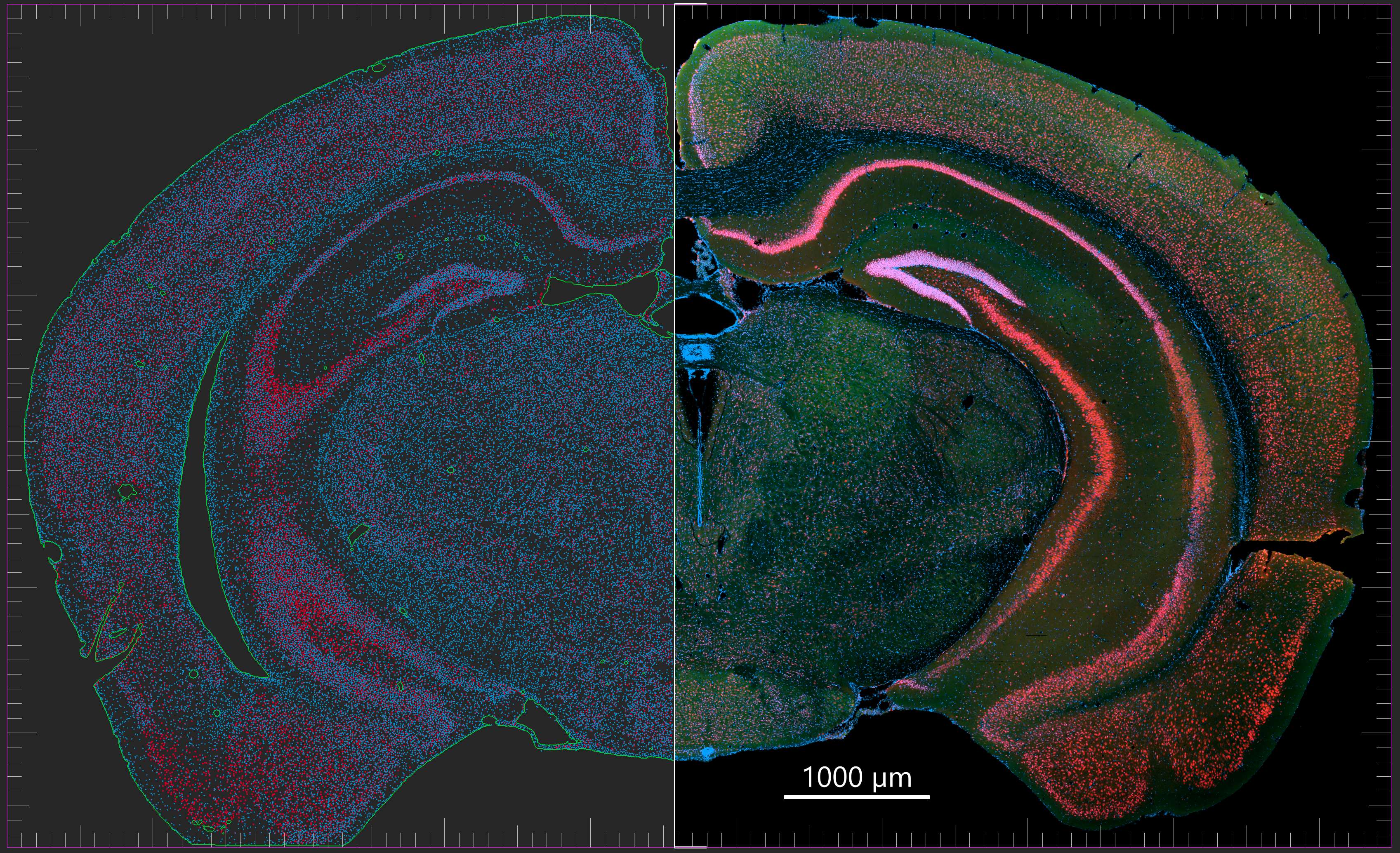 frontal mouse brain section.jpg 