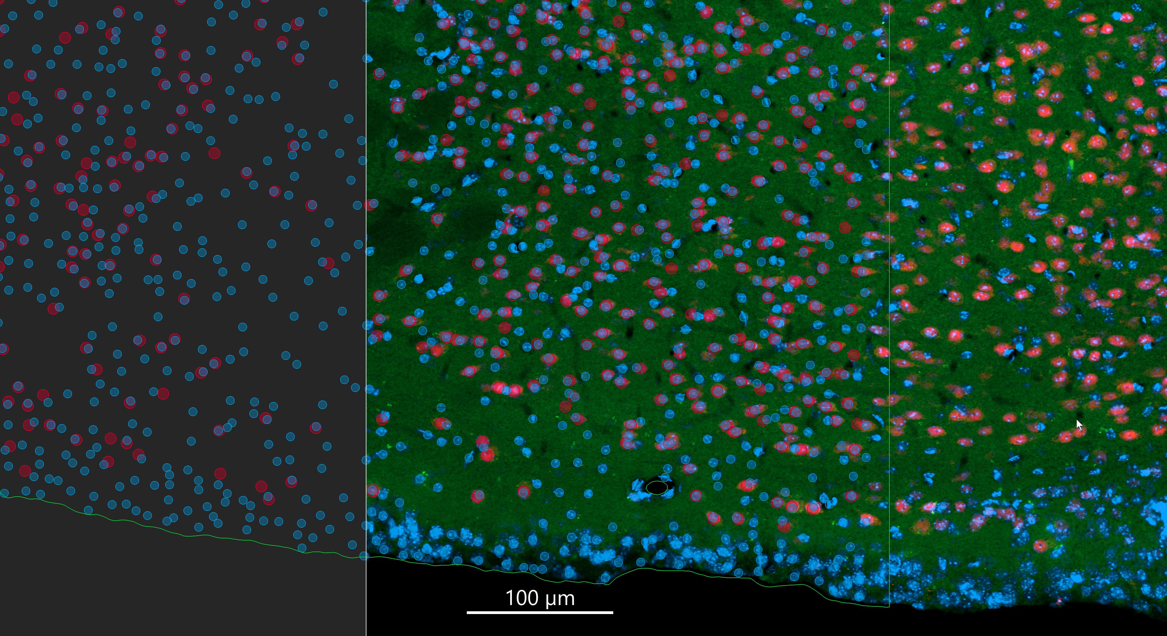 frontal mouse brain section.jpg 